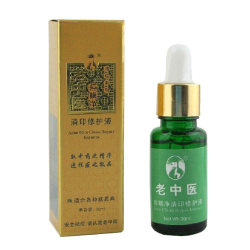 Retirer Imprimer Liquid Réparation éliminer l'acné Essence de médecine chinoise 30ml